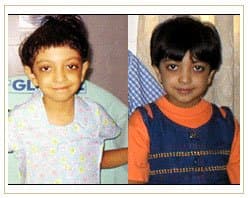 Slider image (7) Global Hospitals